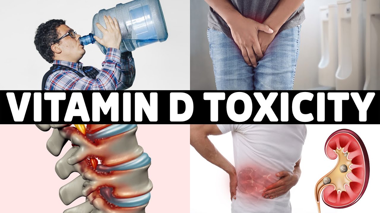 #1 Sign That You Overdosed on Vitamin D