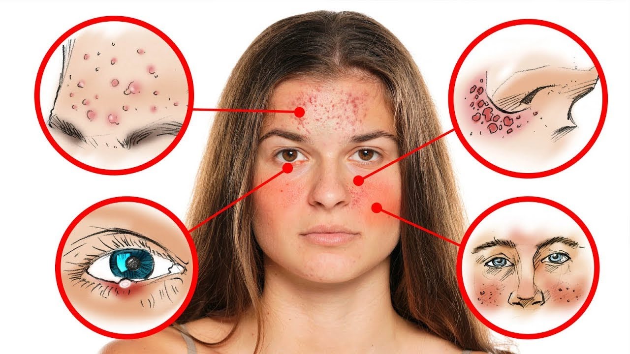 18 Things Your Face Can Tell You about Deep Health Problems