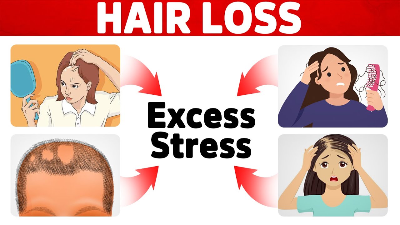 The #1 Hidden Cause of Your Hair Loss (Different Types)