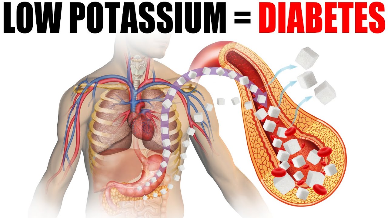 Potassium Deficiency Causes Diabetes