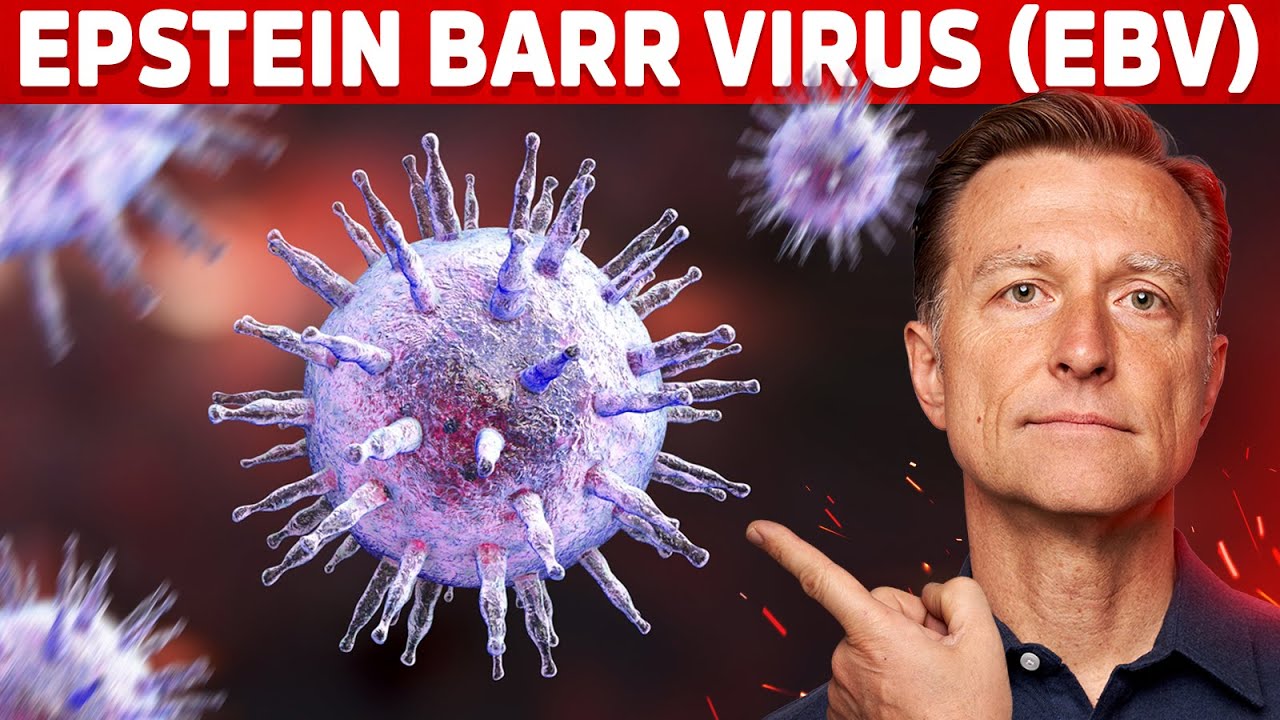 The 5 Things You MUST Know about Epstein-Barr Virus (EBV)