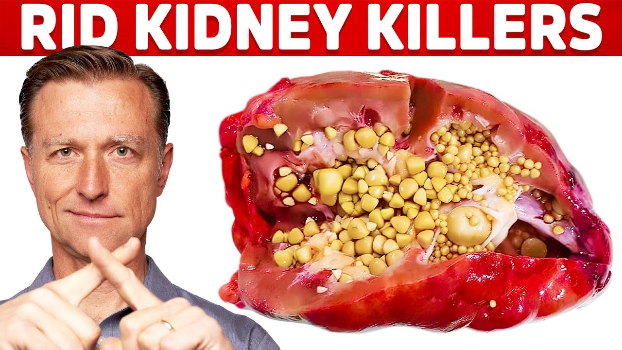 Clean Your Kidneys of Uric Acid and Oxalates