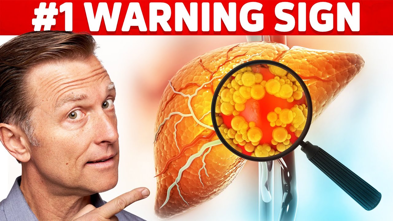 The #1 Top Warning Sign You Have a Fatty Liver